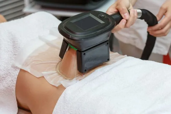 Image of person having fat freezing treatment to help weight gain Binton