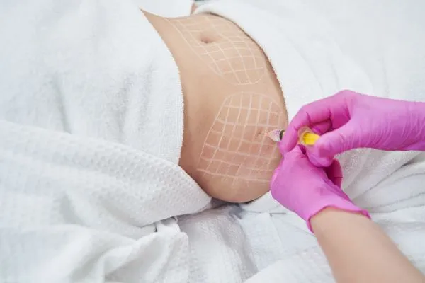image of fat dissolving injections on love handles to help combat weight gain Binton