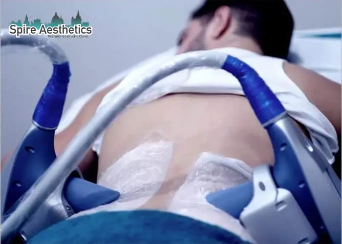 Man having fat freezing treatment done on love handles before a competitions Binton to create a sculpted look.