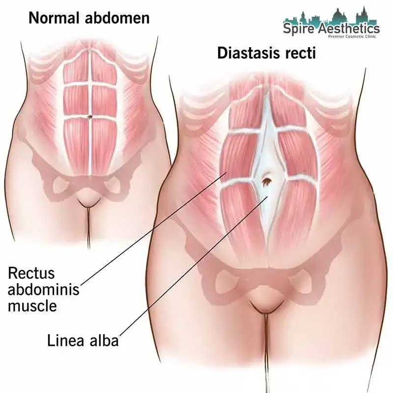 When Will My Belly Feel Normal Again Binton?