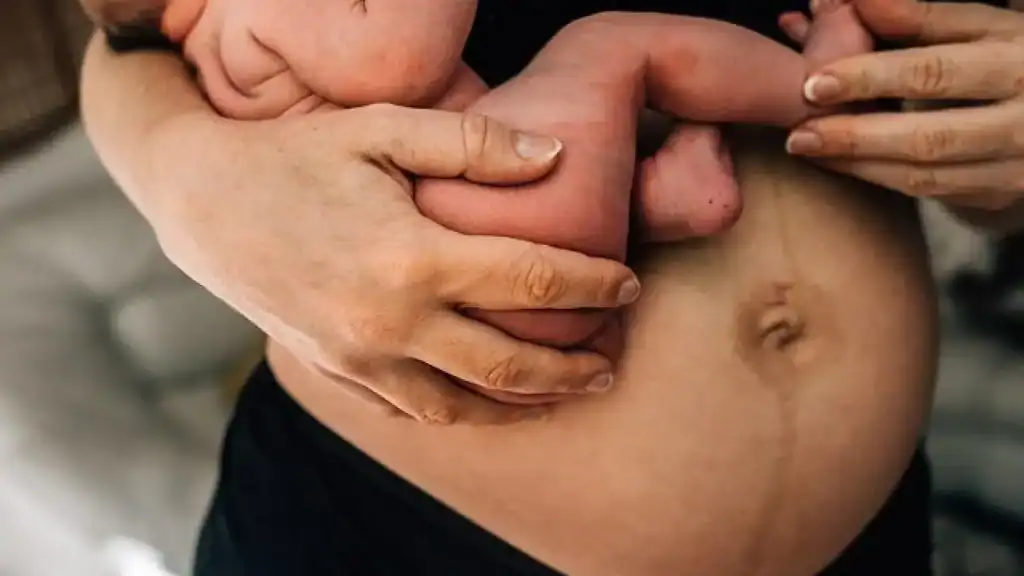 Why Is My Stomach Still Big After Pregnancy Binton?